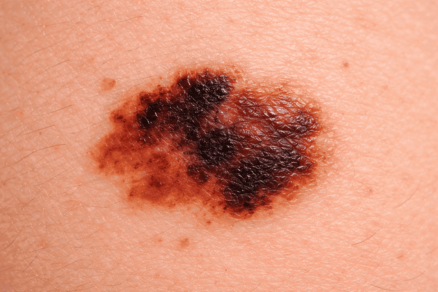 dermatologo-consulta-guatemala-2.png