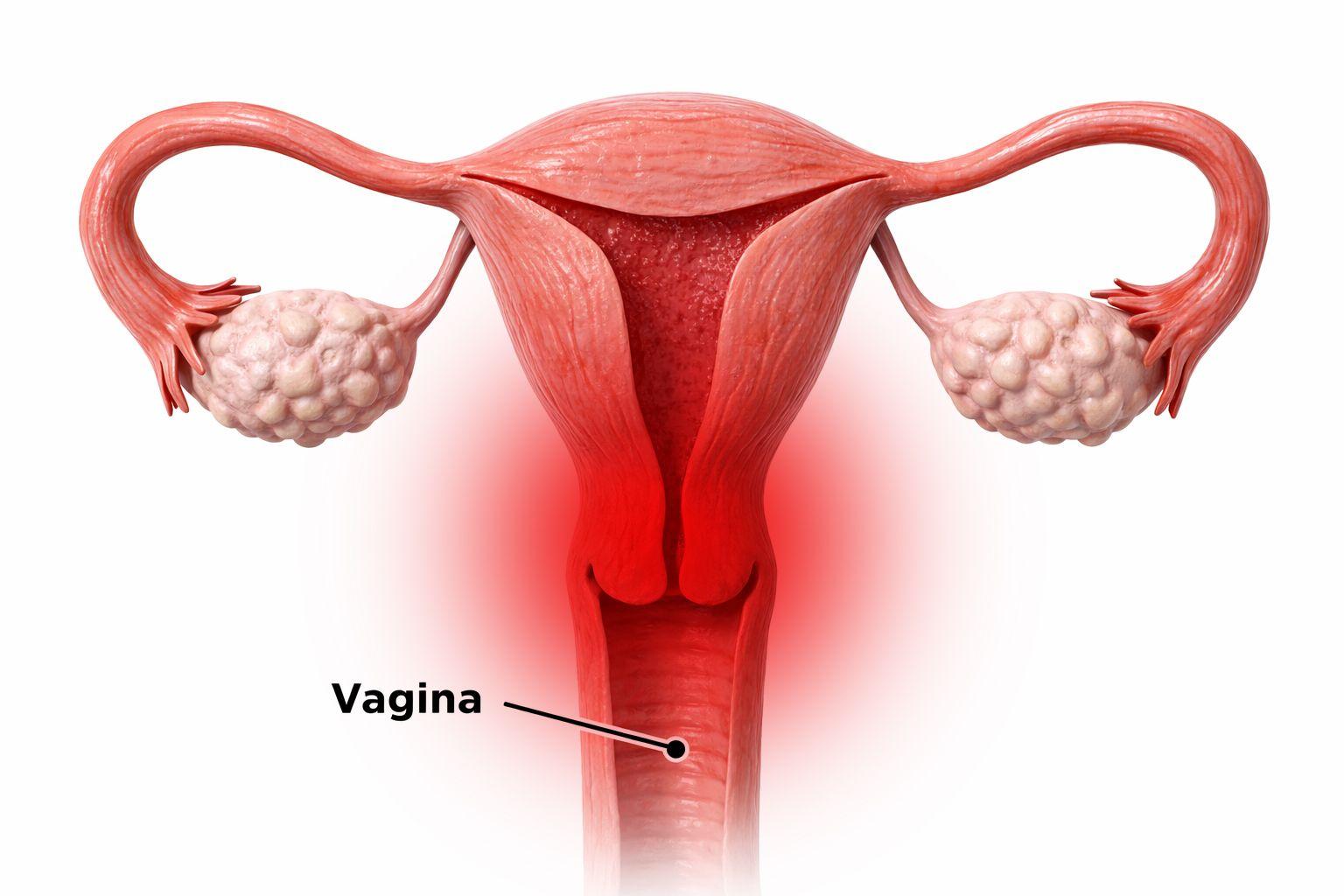 infeccion-vaginal-ginecologo-guatemala-3.jpg